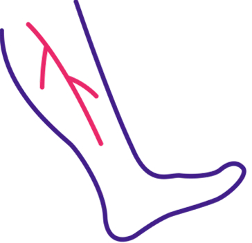 Varicose Veins icon